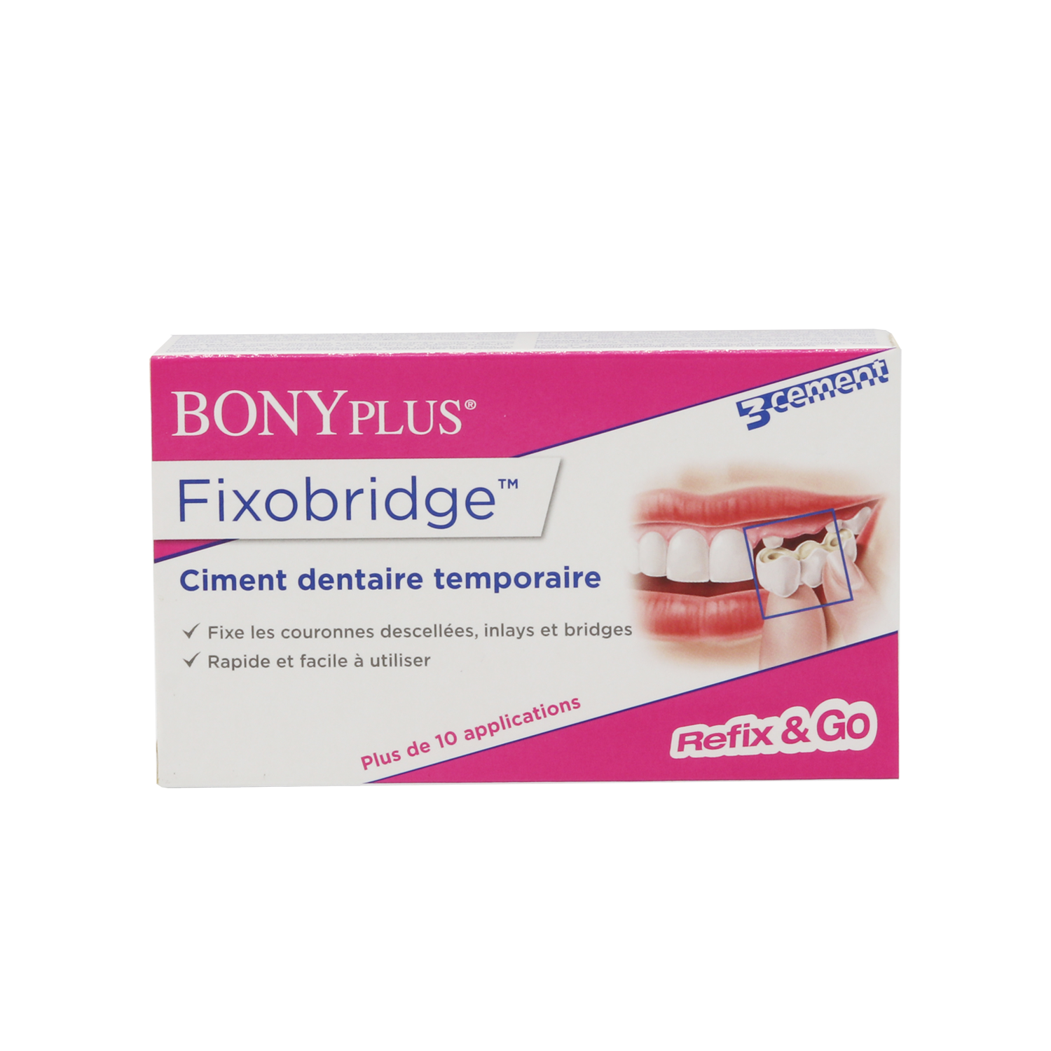 BONYPLUS Fixobridge Repairs crowns, inlays and bridges